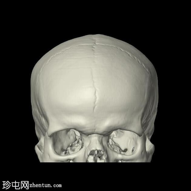 持续性异位缝合